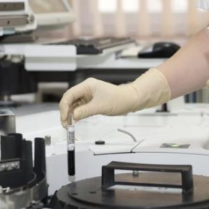 Credito d’imposta in ricerca e sviluppo